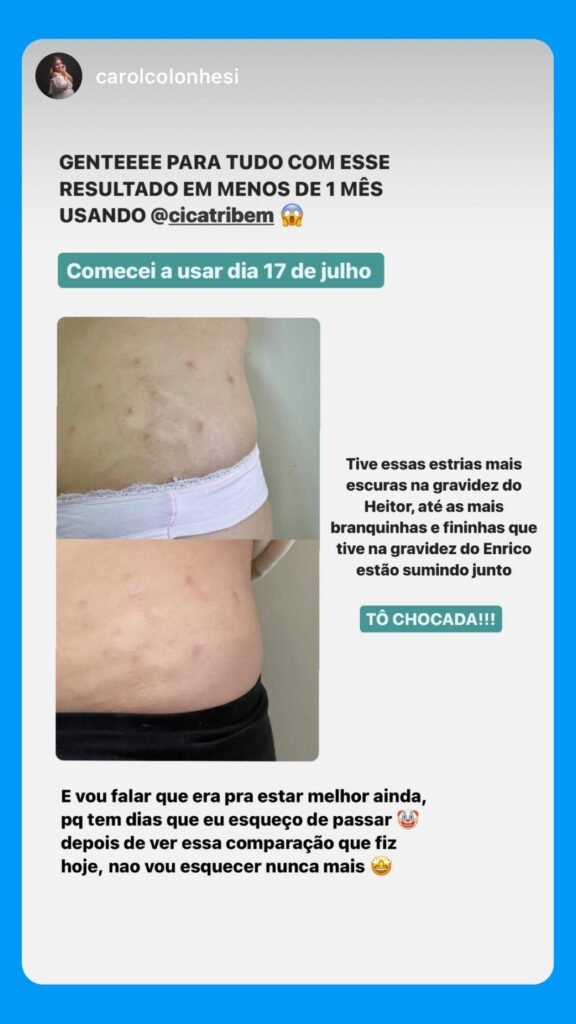 Cicatribem